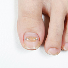 何回ぐらい通えばいいですか？